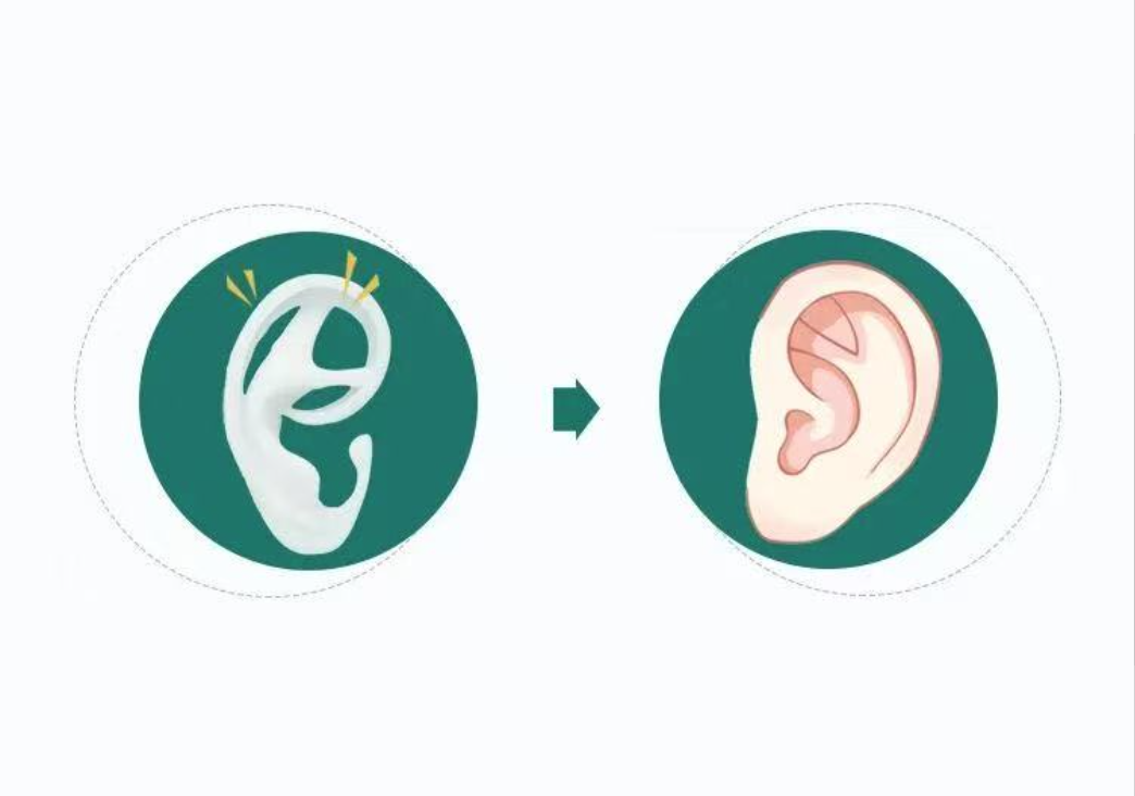 A Brief Understanding of What Microtia Is